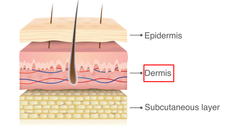 מבנה העור - שכבת הדרמיס בה נמצאים זקיקי השיער 