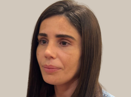 ניתוח אף אחרי