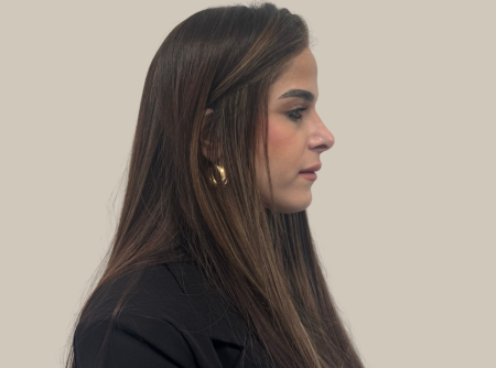 אחרי ניתוח אף