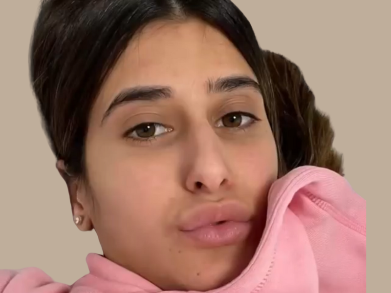 לפני ניתוח אף