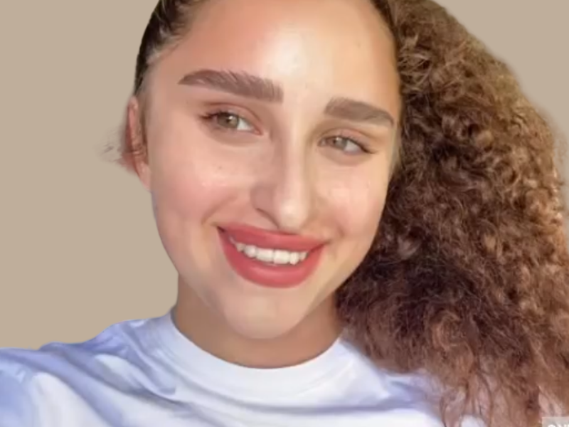 לפני ניתוח אף