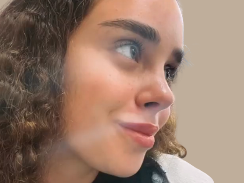 אחרי ניתוח אף