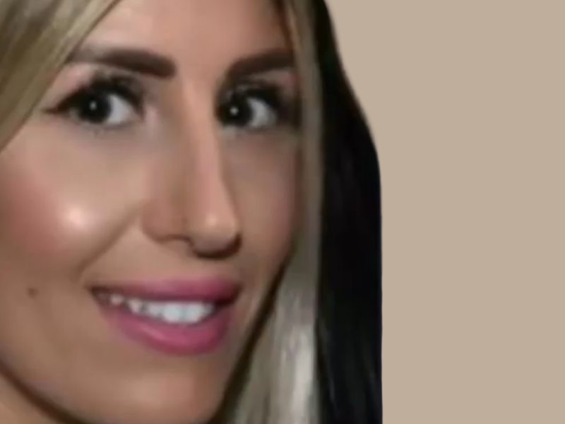 לפני ניתוח אף
