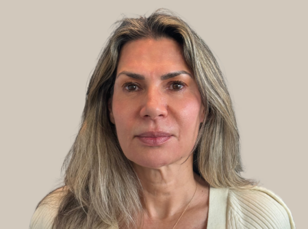 אחרי העלמת קמטים