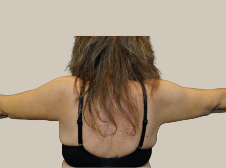 אחרי מתיחת זרועות