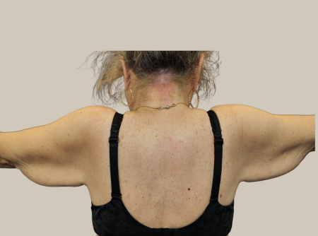 לפני מתיחת זרועות