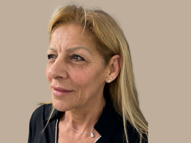 מתיחת פנים