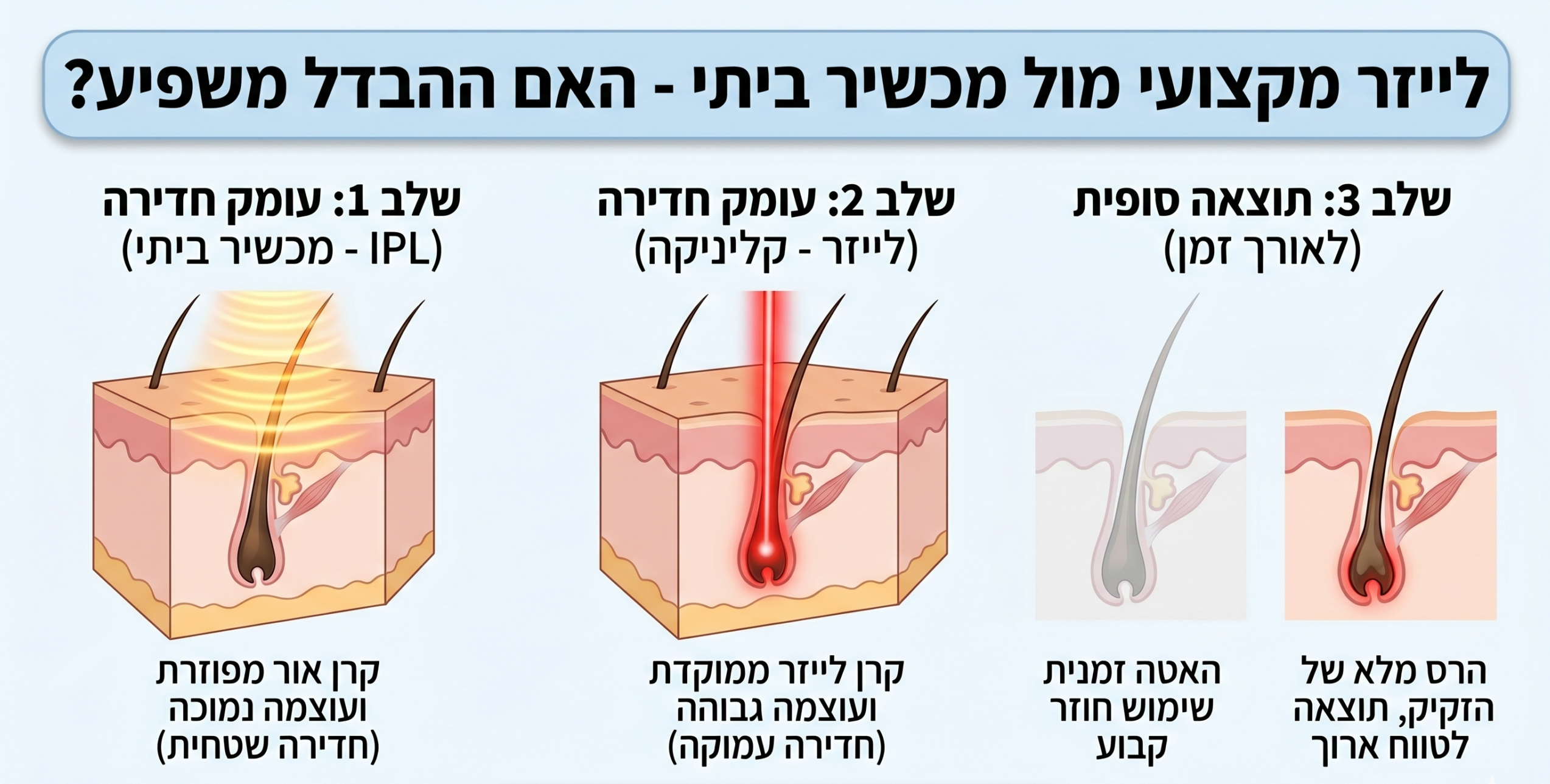 לייזר מקצועי מול מכשיר ביתי